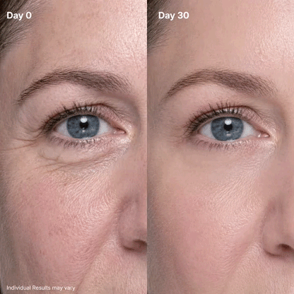 💖Loved & Trusted by Over 50,000 Women💖 Eye Renewal Crème